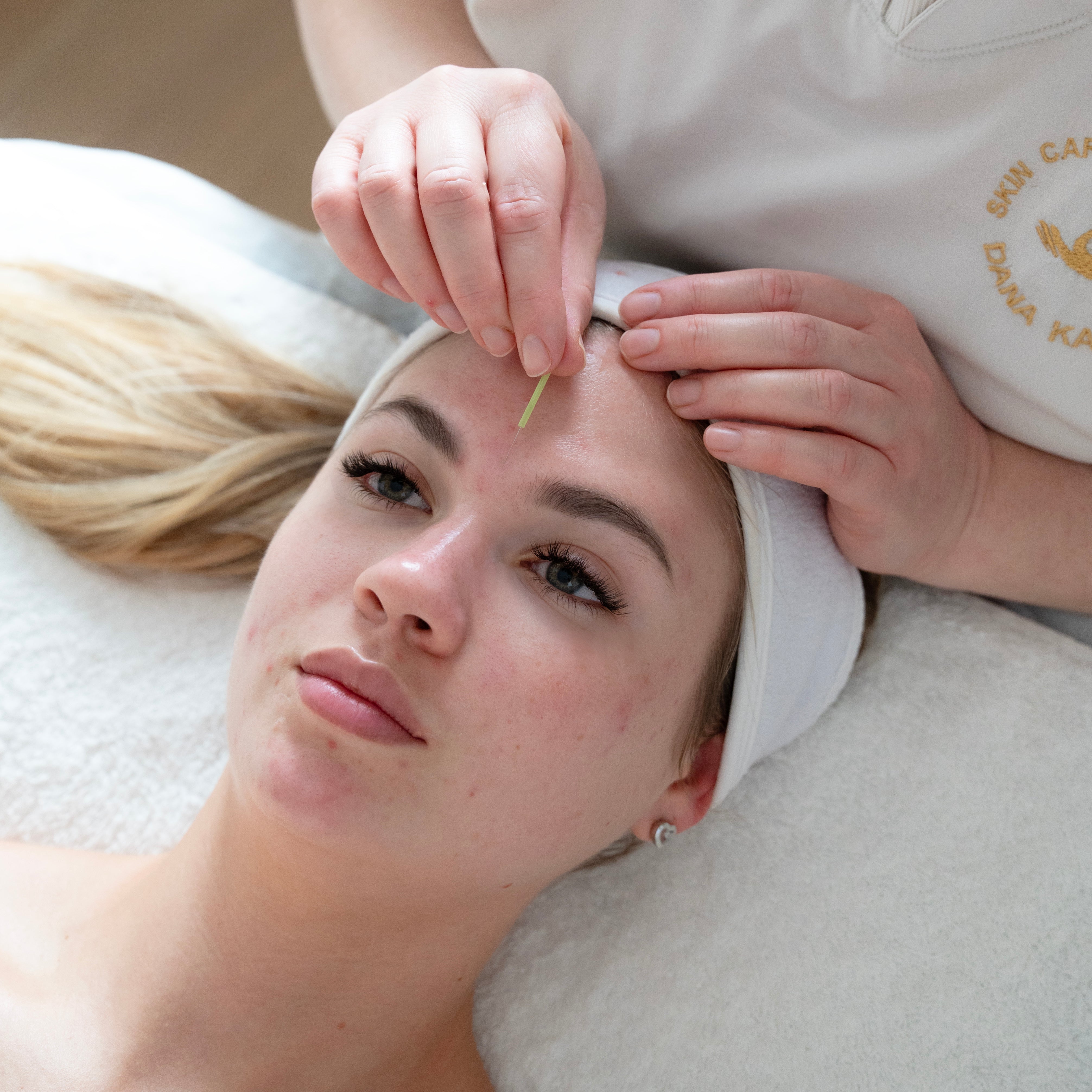 הסודות לטיפול יעיל באקנה: שילוב מנצח של פנים וחוץ