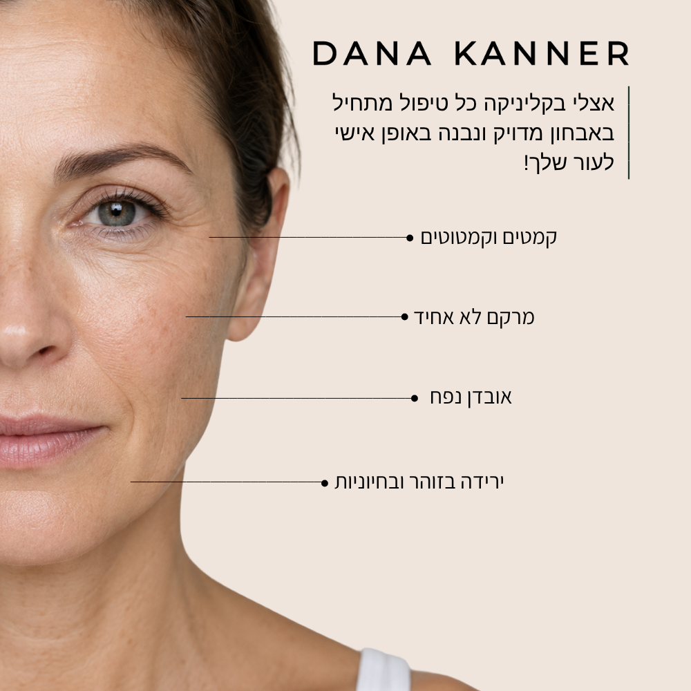 סימני הזדקנות בעור הפנים - קמטים וקמטוטים, מרקם לא אחיד, אובדן נפח וירידה בזוהר