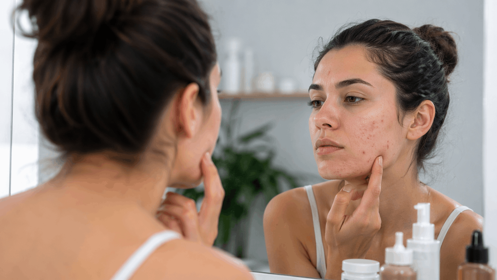 טיפול באקנה בגישה נשית הוליסטית: איך את מאזנת עור רגיש ומחזירה לעצמך ביטחון ב-2026